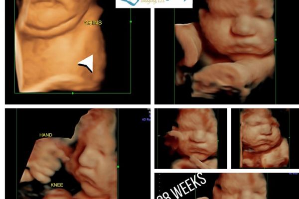 38-weeks-800px9C7B83D8-A332-003C-07DF-409D2B676C2A.jpg