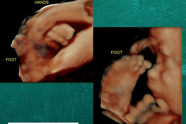 handfoot1-800px1790A877-F8F6-FAB2-9970-48CE63AC69A1.jpg