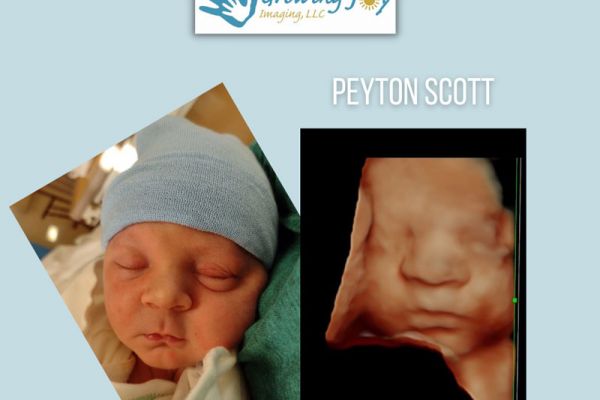 peyton-800px54B7E72F-6F10-D1CB-F603-4393F7DB13A5.jpg